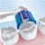 Oral-B - Precision Clean Børstehoveder (4 stk) thumbnail-2