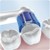 Oral-B - Precision Clean Børstehoveder (8 stk) thumbnail-2