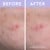 Florence by Mills - Skincare Cleanse Spot a Spot Patches 1 thumbnail-5