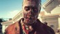 Dead Island 2 /Xbox One thumbnail-3